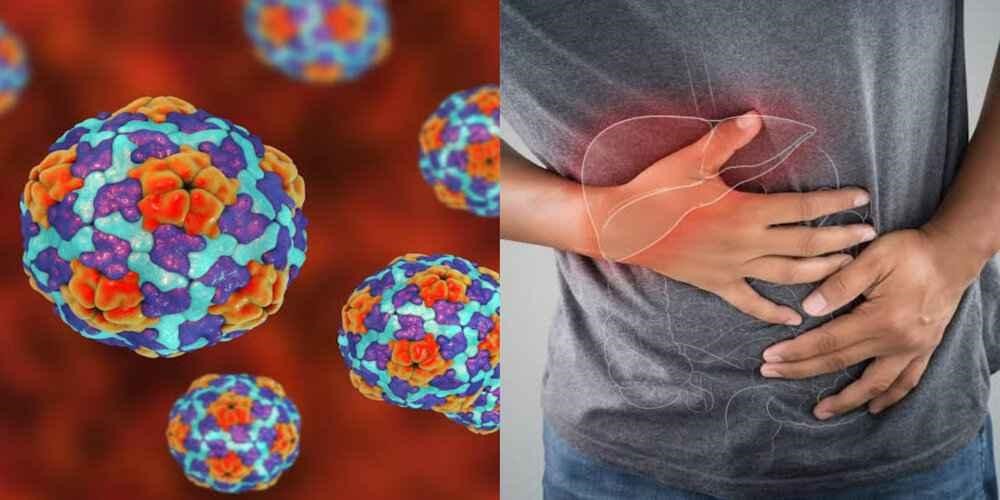 Hepatitis: Penyebab, Gejala, Pengobatan, Dan Tindak Pencegahannya