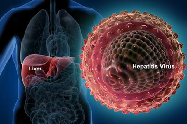 Waspada Hepatitis Akut, Simak Beragam Informasi Mengenai Penyakit Hepatitis Akut-3